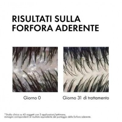 Vichy Dercos Shampoo Antiforfora Capelli Grassi 200 ml
